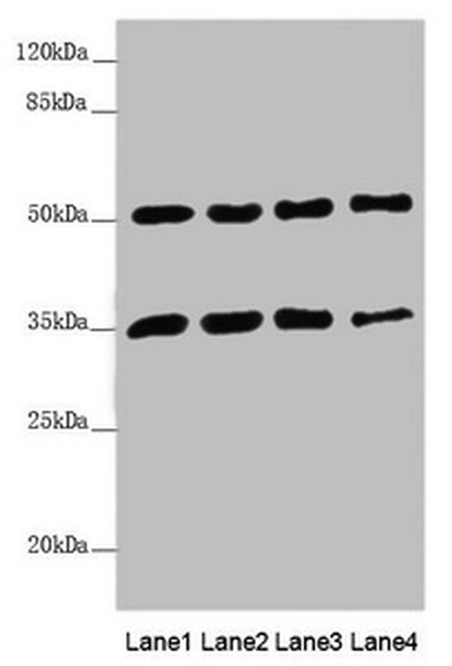 MTX1 Antibody in Western Blot (WB)