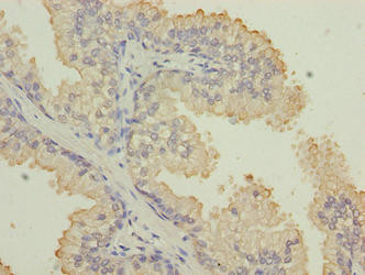 Cytokeratin 33B Antibody in Immunohistochemistry (Paraffin) (IHC (P))