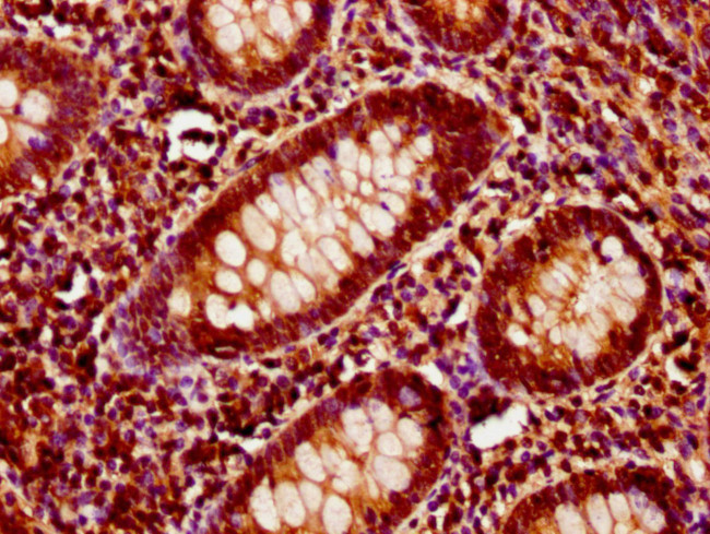 ITSN1 Antibody in Immunohistochemistry (Paraffin) (IHC (P))