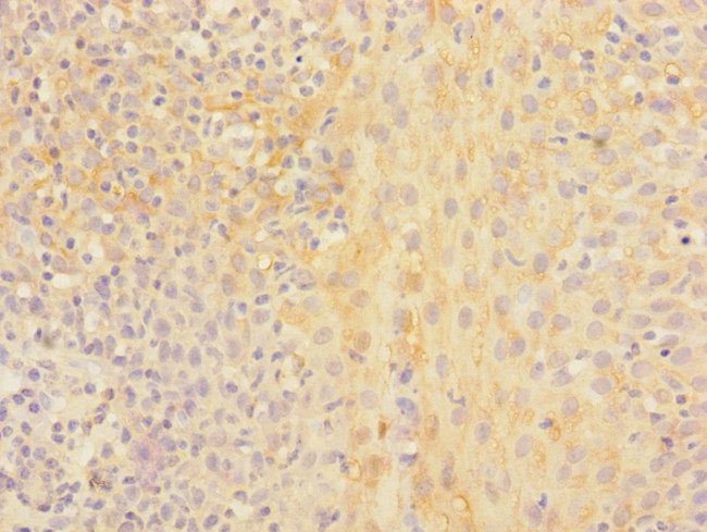 CHRNA2 Antibody in Immunohistochemistry (Paraffin) (IHC (P))