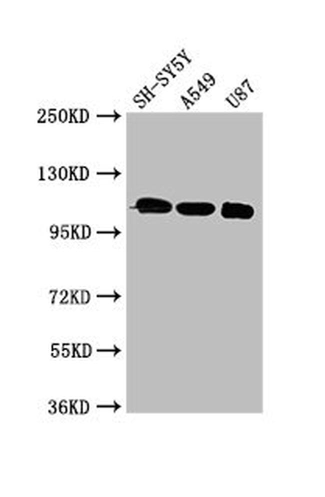 LRP8 Antibody in Western Blot (WB)