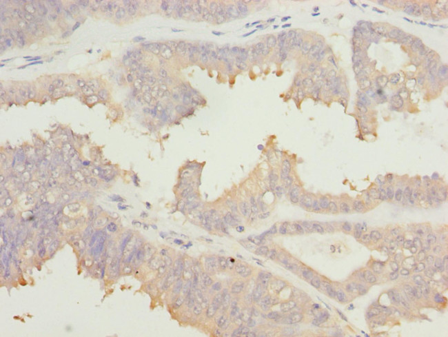 eIF2b alpha Antibody in Immunohistochemistry (Paraffin) (IHC (P))