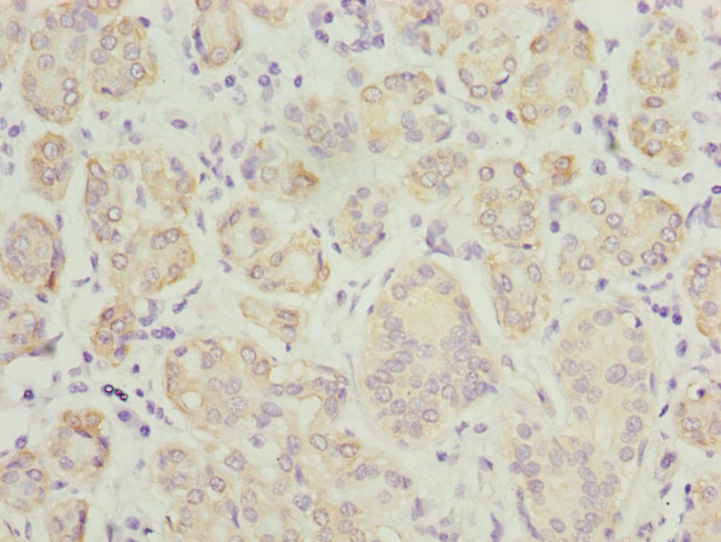 TPD52L1 Antibody in Immunohistochemistry (Paraffin) (IHC (P))
