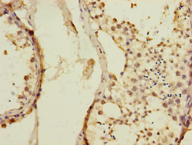 KIZUNA Antibody in Immunohistochemistry (Paraffin) (IHC (P))