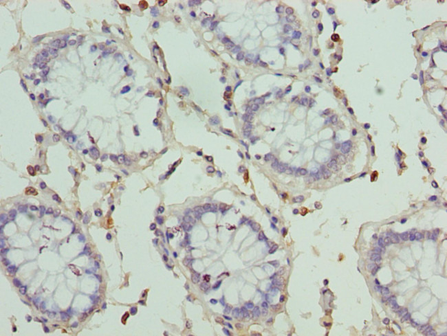 HKDC1 Antibody in Immunohistochemistry (Paraffin) (IHC (P))
