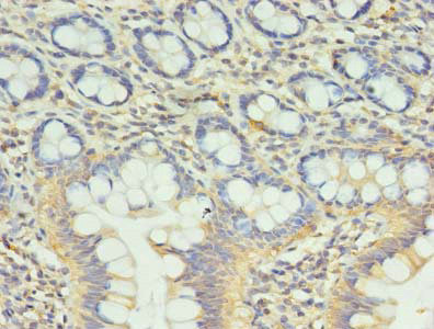 CCDC57 Antibody in Immunohistochemistry (Paraffin) (IHC (P))