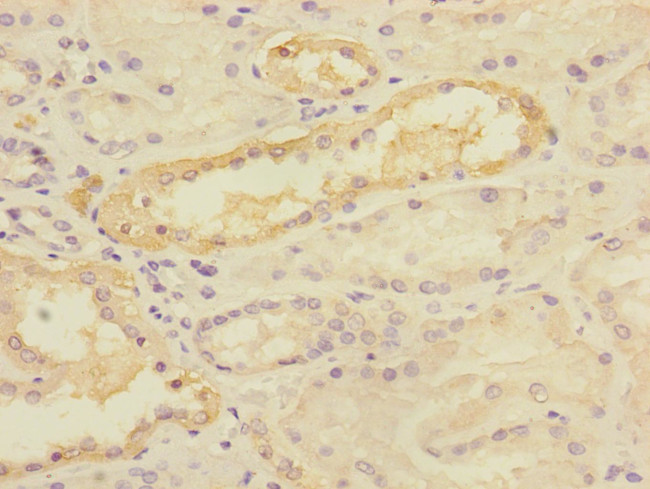 TIMM50 Antibody in Immunohistochemistry (Paraffin) (IHC (P))