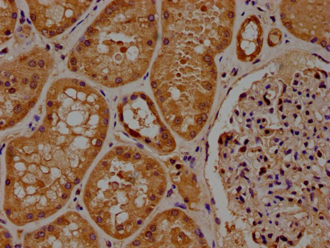 PPM1J Antibody in Immunohistochemistry (Paraffin) (IHC (P))