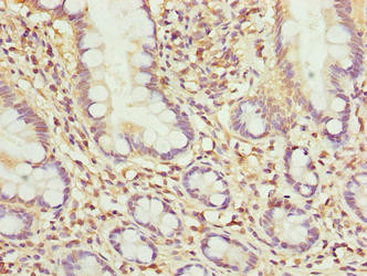 MRPL51 Antibody in Immunohistochemistry (Paraffin) (IHC (P))