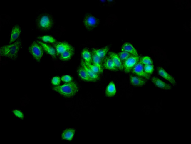ARSH Antibody in Immunocytochemistry (ICC/IF)
