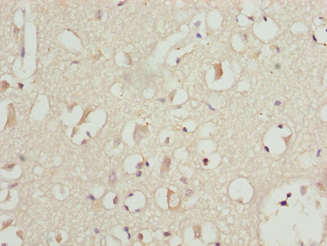 PITRM1 Antibody in Immunohistochemistry (Paraffin) (IHC (P))