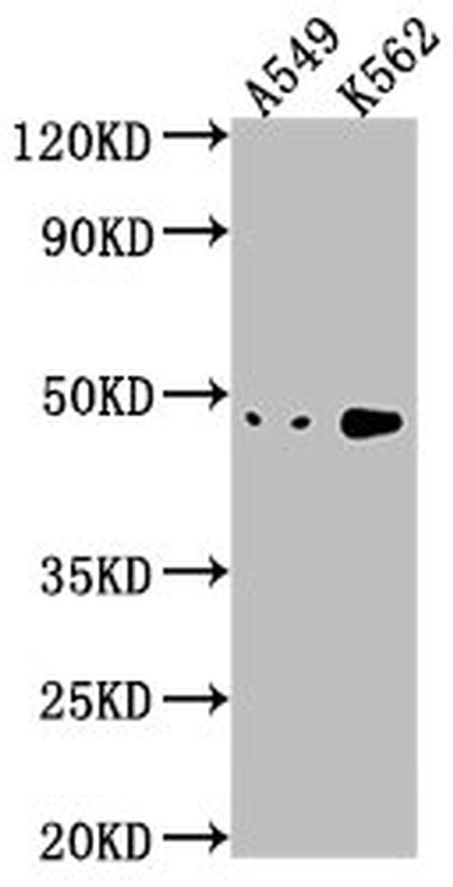 NKAPL Antibody in Western Blot (WB)