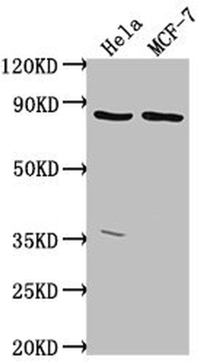 TTC39B Antibody in Western Blot (WB)