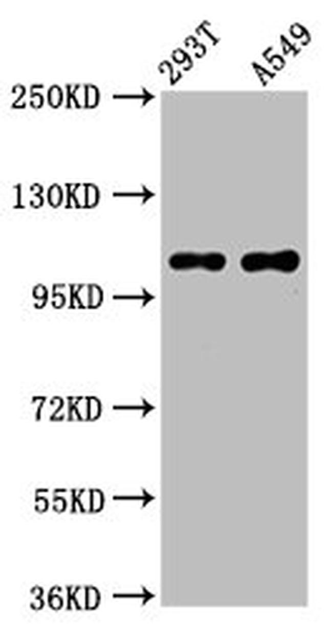NARG2 Antibody in Western Blot (WB)