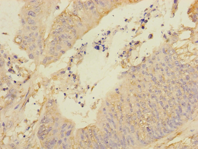 REEP5 Antibody in Immunohistochemistry (Paraffin) (IHC (P))