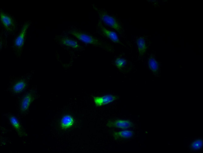 ATL3 Antibody in Immunocytochemistry (ICC/IF)