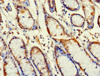 RBG1L Antibody in Immunohistochemistry (Paraffin) (IHC (P))