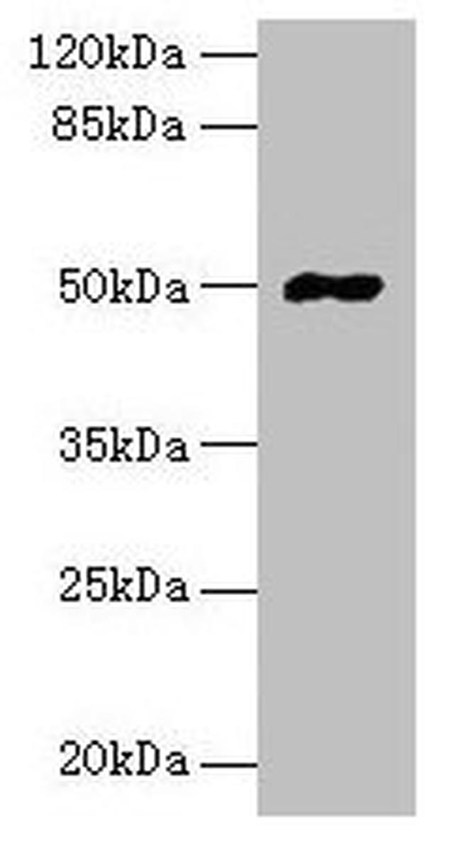 FAM69A Antibody in Western Blot (WB)