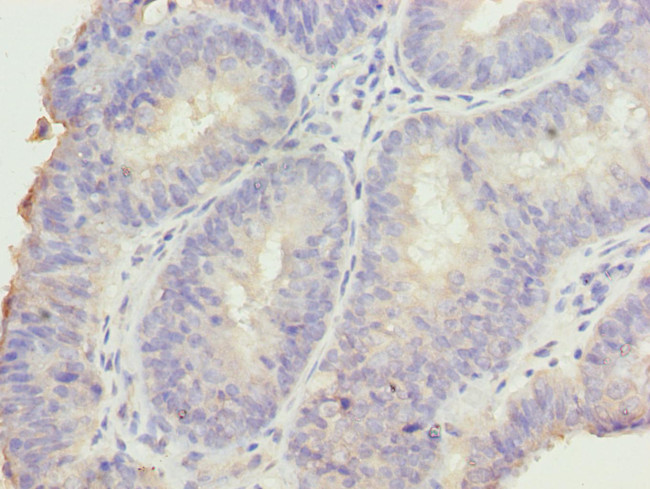 DDI2 Antibody in Immunohistochemistry (Paraffin) (IHC (P))