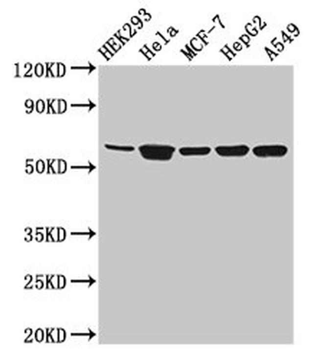 CYP4F22 Antibody in Western Blot (WB)