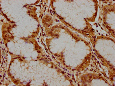 PKN3 Antibody in Immunohistochemistry (Paraffin) (IHC (P))