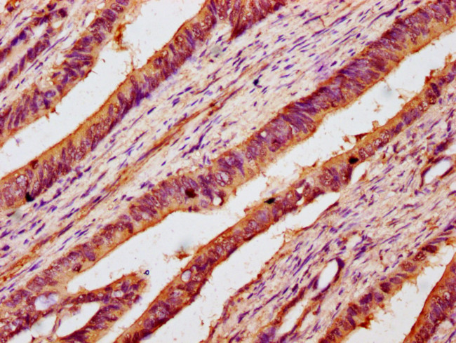 B3GNT6 Antibody in Immunohistochemistry (Paraffin) (IHC (P))
