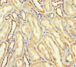 AspRS Antibody in Immunohistochemistry (Paraffin) (IHC (P))