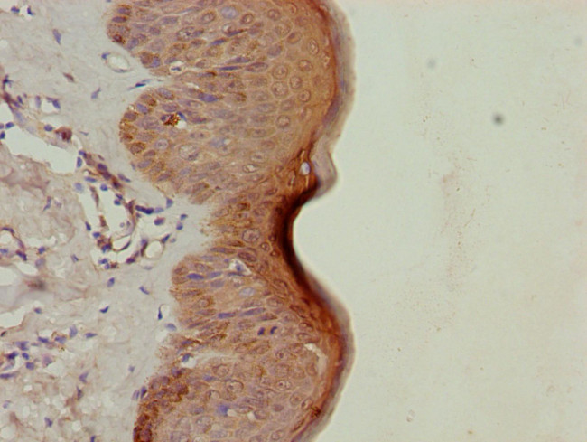 LRSAM1 Antibody in Immunohistochemistry (Paraffin) (IHC (P))