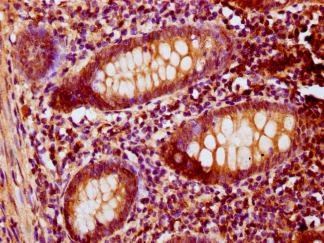 PNCK Antibody in Immunohistochemistry (Paraffin) (IHC (P))