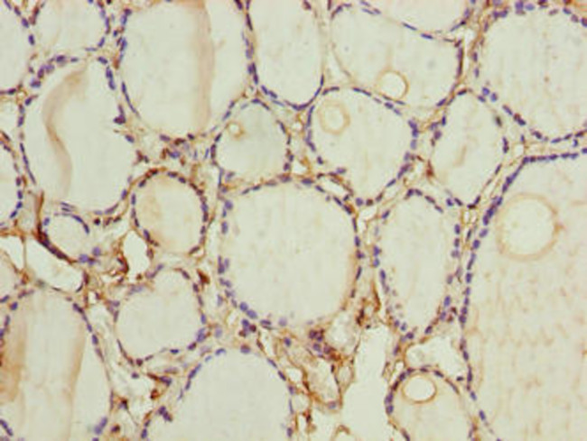 FOXR2 Antibody in Immunohistochemistry (Paraffin) (IHC (P))