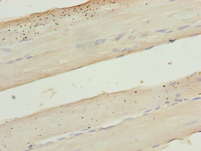KRT80 Antibody in Immunohistochemistry (Paraffin) (IHC (P))