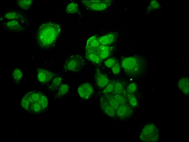 MACC1 Antibody in Immunocytochemistry (ICC/IF)