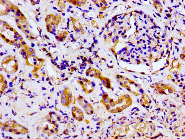 MARK2 Antibody in Immunohistochemistry (Paraffin) (IHC (P))