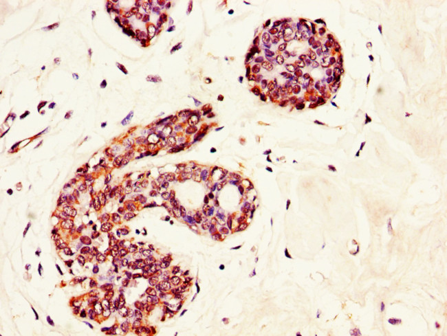 GRAMD4 Antibody in Immunohistochemistry (Paraffin) (IHC (P))