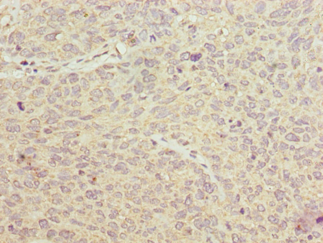 PGM2L1 Antibody in Immunohistochemistry (Paraffin) (IHC (P))