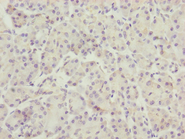 TTLL7 Antibody in Immunohistochemistry (Paraffin) (IHC (P))