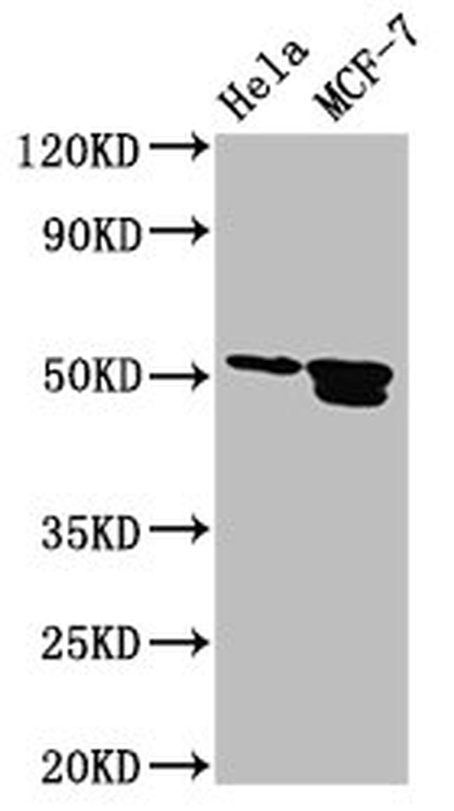 AP2 beta Antibody in Western Blot (WB)