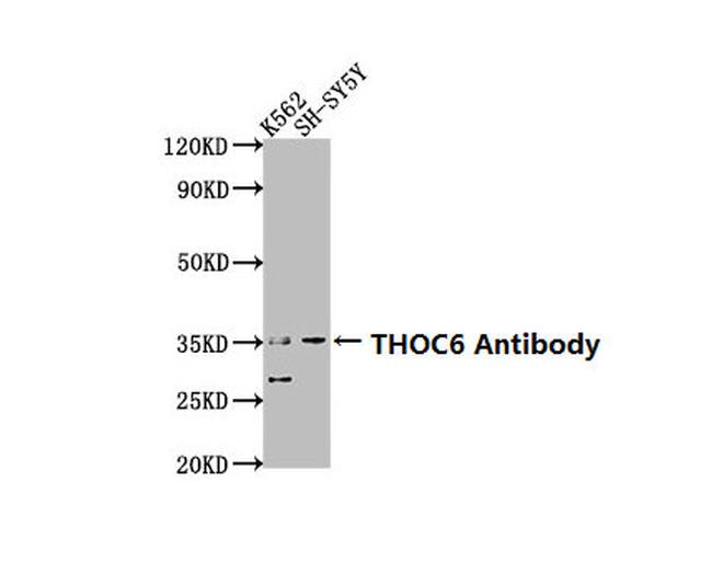 THOC6 Antibody in Western Blot (WB)