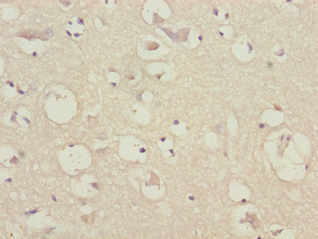 CEP57 Antibody in Immunohistochemistry (Paraffin) (IHC (P))