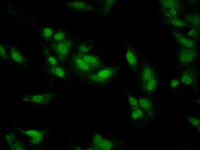 LDB1 Antibody in Immunocytochemistry (ICC/IF)