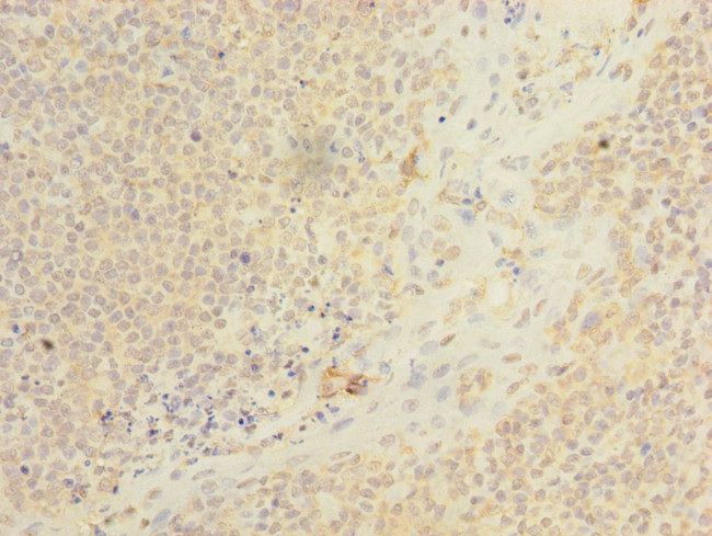 ARMC9 Antibody in Immunohistochemistry (Paraffin) (IHC (P))