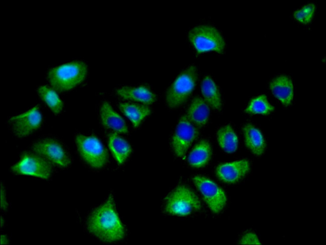 SPRED1 Antibody in Immunocytochemistry (ICC/IF)