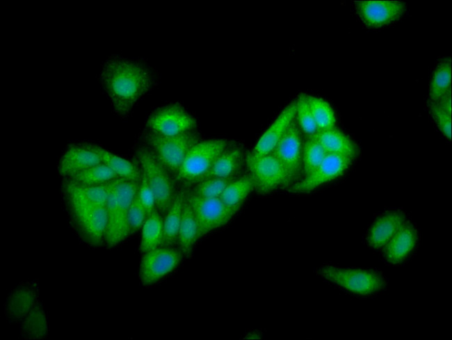 PNPLA5 Antibody in Immunocytochemistry (ICC/IF)