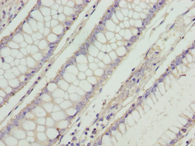 RD3 Antibody in Immunohistochemistry (Paraffin) (IHC (P))
