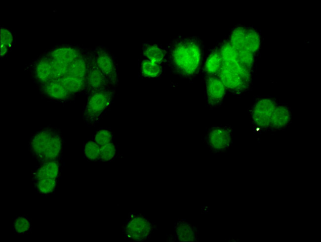 CHD1L Antibody in Immunocytochemistry (ICC/IF)