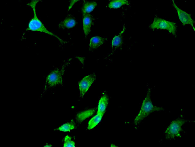 SEPT12 Antibody in Immunocytochemistry (ICC/IF)