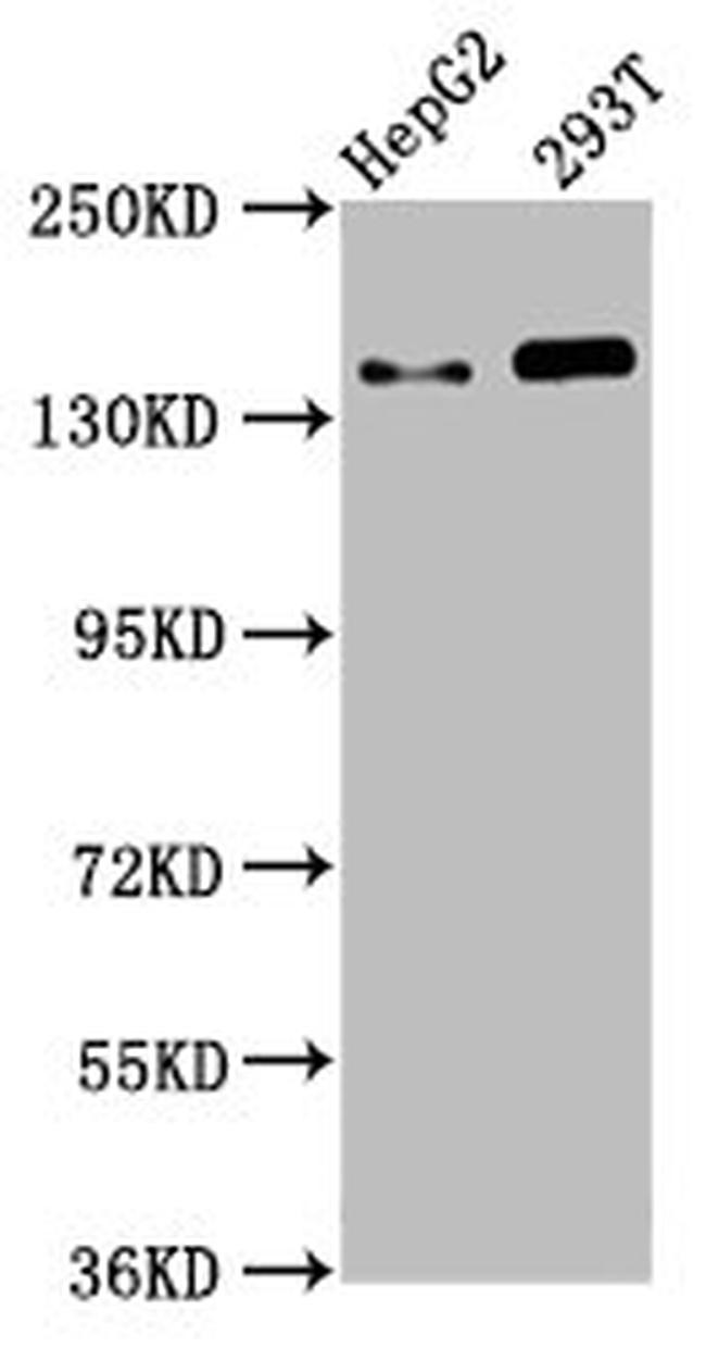 SMC5 Antibody in Western Blot (WB)