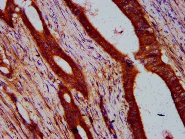 ULK2 Antibody in Immunohistochemistry (Paraffin) (IHC (P))