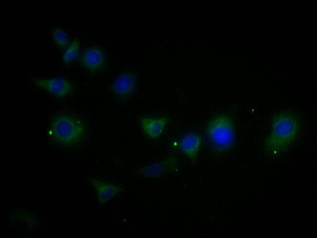 MMD2 Antibody in Immunocytochemistry (ICC/IF)