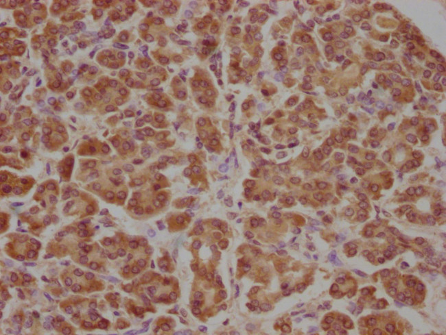 APCDD1 Antibody in Immunohistochemistry (Paraffin) (IHC (P))